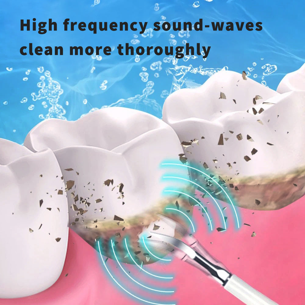 Ultrasonic Tooth Cleaning